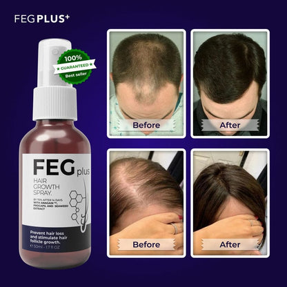 FEG Plus Hair Growth Spray Original-USA